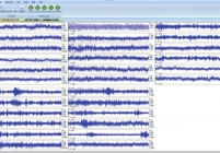 随掘地震数据采集控制软件界面